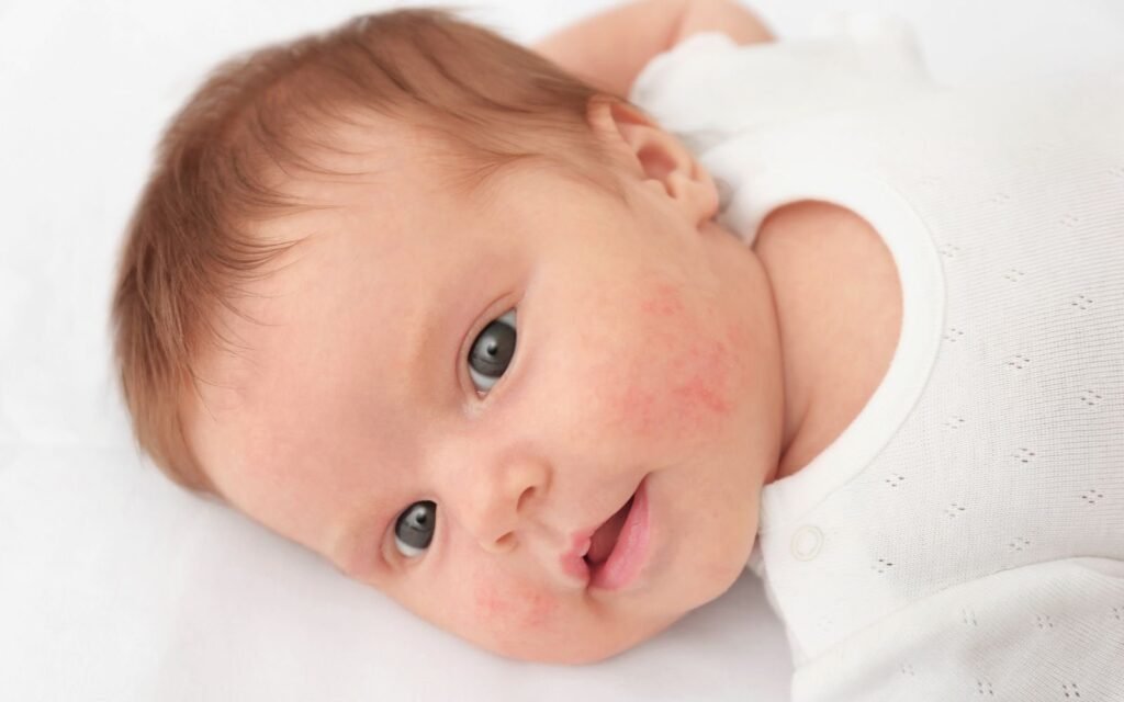 Protect The Skin From Drool Rash